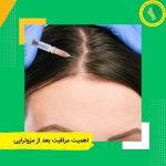 اهمیت مراقبت بعد از مزوتراپی