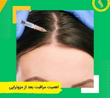 اهمیت مراقبت بعد از مزوتراپی