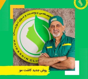 روش جدید کاشت مو DHI
