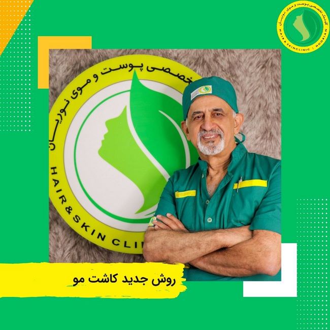 روش جدید کاشت مو DHI